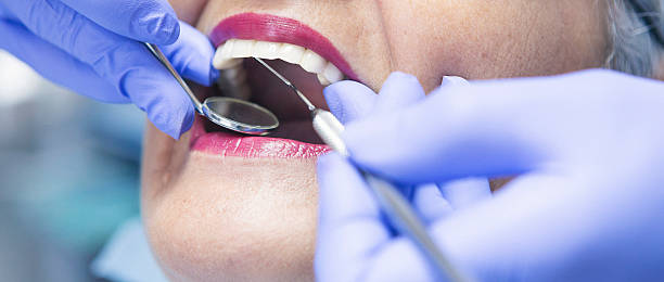 Best Emergency Treatment for Dental Infections or Abscesses in Florence, AZ